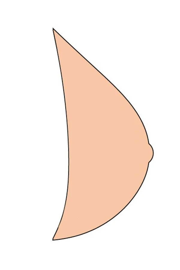 Hakuun Tubular Breast Normal Breast Vector Modern liittyvä